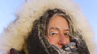 طرق الوقاية من مضاعفات عضة الصقيع الخطيرة